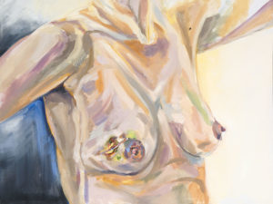 oil painting showing my breasts and bruising after MRI biopsies.