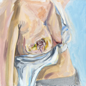 oil painting of my breast just after first surgery, a lumpectomy.